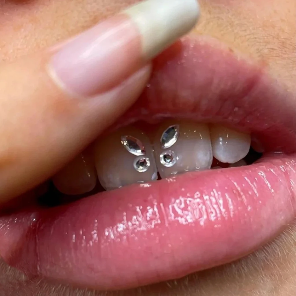 Obrázok /content/50pcs-zubné-diamant-kryštál-bielenie-zubov-klincami-6-430.jpeg